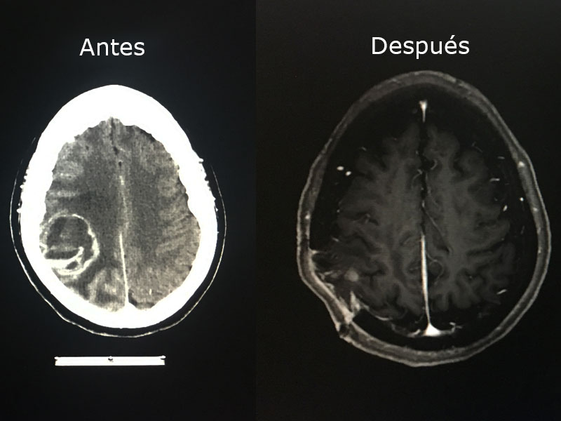 DRJournalMetastasis DRJournalMetastasis