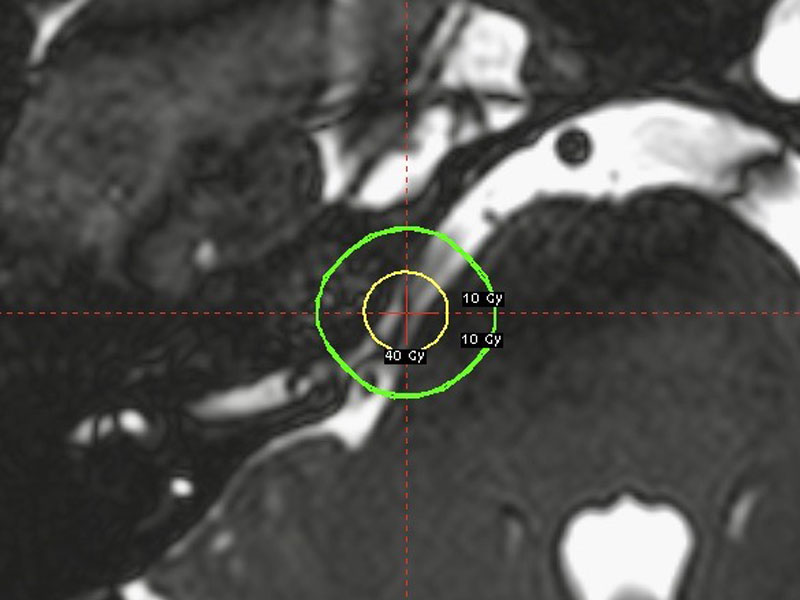 DRJournalNeuralgiaDelTrigemino